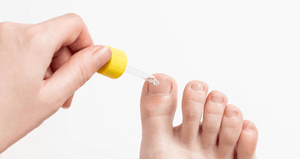 How to Treat Nail Fungus: The Definitive Guide