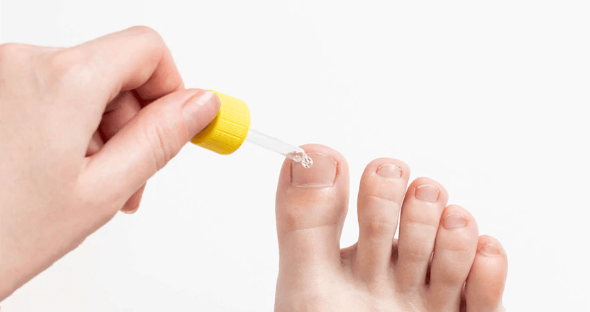 Herbal Fungal Nail Treatment Essential oil Hand and Foot Whitening Toe Nail  Fungus Removal Infection Feet Care Polish Nail Gel - Price history & Review  | AliExpress Seller - OEDO Official Store | Alitools.io