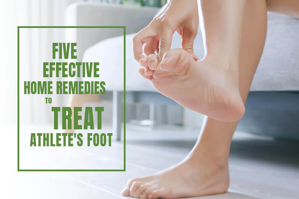 5 Effective Home Remedies to Treat Athlete's Foot