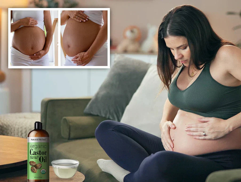 Castor Oil for Stretch Marks Your Complete Guide to Natural Healing