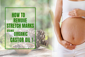 Effective Ways to Use Organic Castor Oil for Stretch Marks