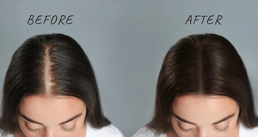 How a Scalp Massage Will Improve Hair Health |