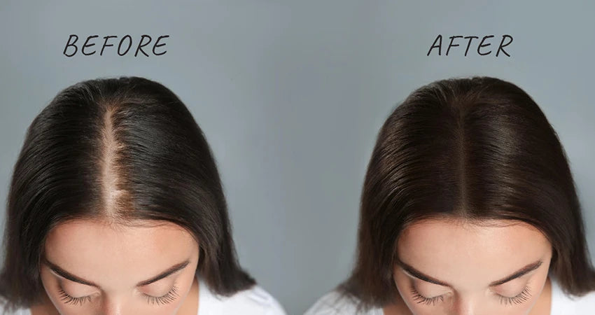 Castor oil for online hair loss