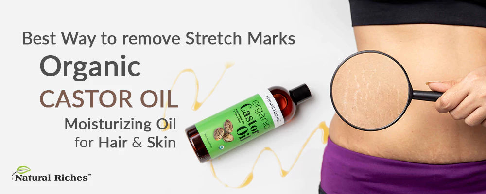 Best Organic Castor Oil For Stretch Mark