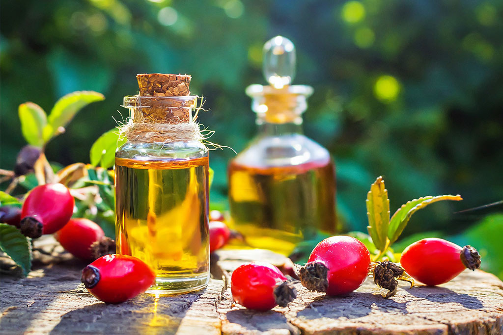 Natural Riches Rosehip oil for and its benefits