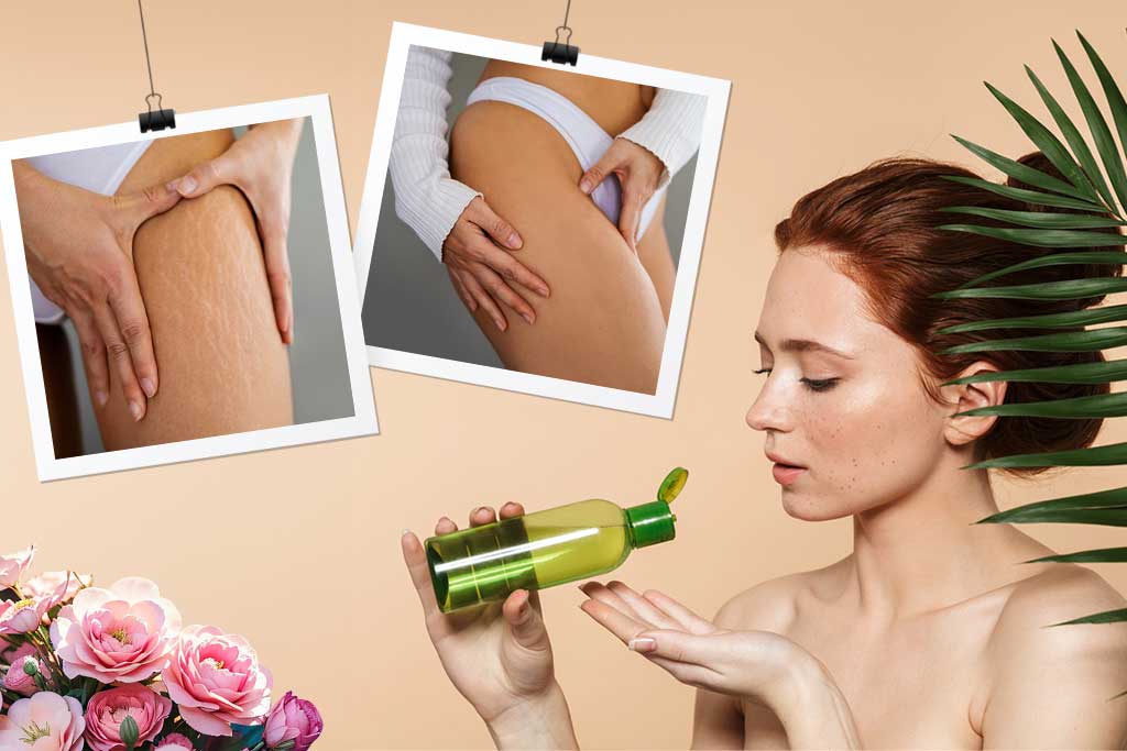 8 Top Skin Care Oils for Scar and Stretch Mark Removal