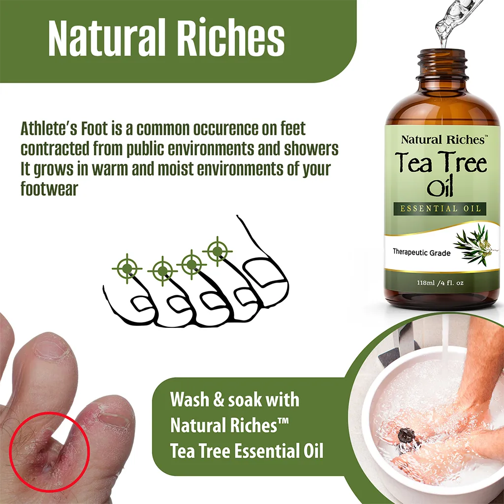 Natural Riche Pure Tea Tree Essential Oil Therapeutic Grade