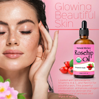 Natural Riches Rosehip Oil for beautiful skin and face care