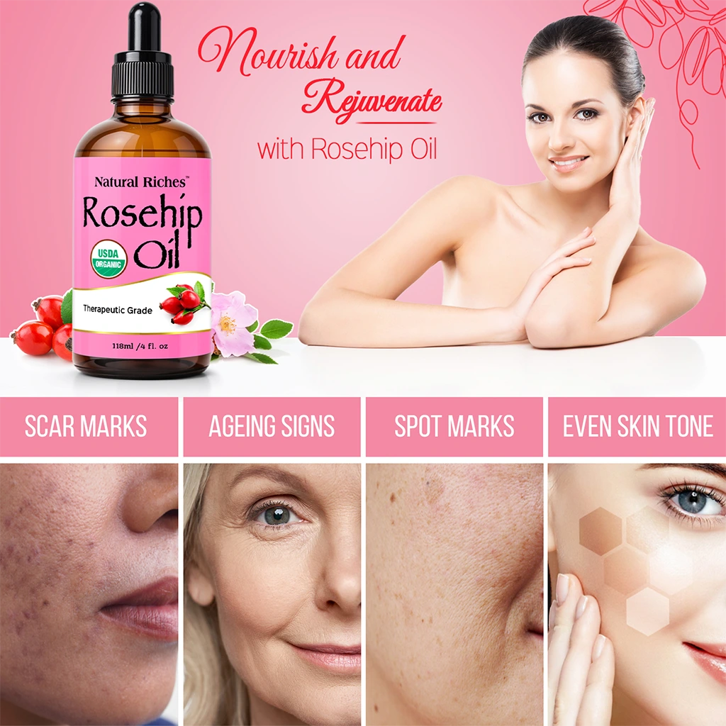 Natural Riches Rosehip Oil for beautiful skin and face care