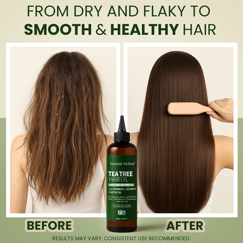 Tea tree hair oil bottle with 'Before' and 'After' hair comparison on a beige background